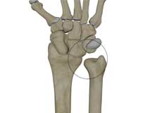 Distal Radioulnar Joint